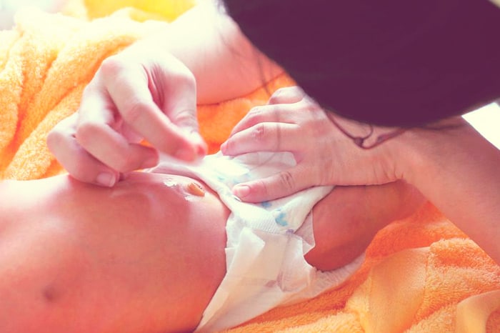 iFraldas - Como cuidar do umbigo do bebê
